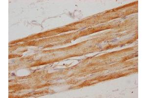 IHC image of ABIN7160584 diluted at 1:100 and staining in paraffin-embedded human skeletal muscle tissue performed on a Leica BondTM system. (MYH6 anticorps  (AA 894-1132))