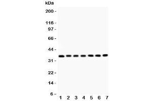Western blot testing of RACK1 antibody and Lane 1:  mouse liver;  2: rat spleen;  3: (m) spleen;  4: human SMMC-7721;  5: (h) HEPG2;  6: (m) HEPA;  7: (r) RH35 lysate. (GNB2L1 anticorps  (AA 2-317))