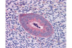 Anti-GART antibody IHC of human uterus. (GART anticorps  (AA 1-434))