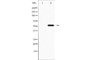 Western blot analysis of p70 S6 Kinase beta phosphorylation expression in EGF treated K562 whole cell lysates,The lane on the left is treated with the antigen-specific peptide. (RPS6KB2 anticorps  (pSer423))