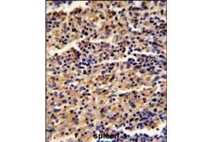 Formalin-fixed and paraffin-embedded human spleen reacted with ALKBH8 Antibody , which was peroxidase-conjugated to the secondary antibody, followed by DAB staining. (ALKBH8 anticorps  (C-Term))