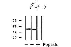 Western blot analysis of extracts from Jurkat/293 cells, using B4GALT1 antibody.