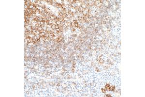 Immunohistochemistry (IHC) image for anti-CD40 (CD40) (AA 227-277) antibody (ABIN7454023) (Recombinant CD40 anticorps  (AA 227-277))