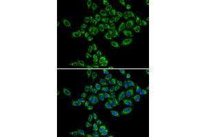 Immunofluorescence analysis of HeLa cells using SRPK1 antibody. (SRPK1 anticorps)