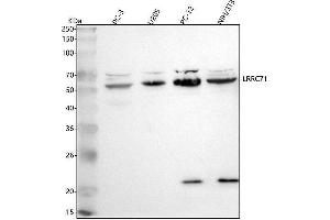 anti-Leucine Rich Repeat Containing 71 (LRRC71) (AA 35-543) antibody