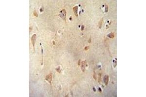 Immunohistochemistry analysis in formalin fixed and paraffin embedded human brain tissue reacted with  LRRC40 Antibody (C-term) followed which was peroxidase conjugated to the secondary antibody and followed by  DAB staining. (LRRC40 anticorps  (C-Term))