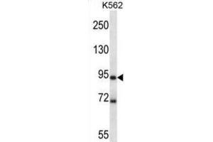 Western Blotting (WB) image for anti-MAP/microtubule Affinity-Regulating Kinase 1 (MARK1) antibody (ABIN2997857)