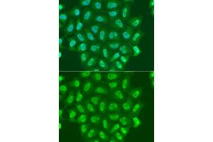 Immunofluorescence analysis of A549 cell using POLR2A antibody. (POLR2A/RPB1 anticorps)