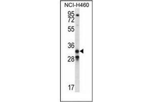 Western blot analysis of GDF15 Antibody (N-term) in NCI-H460 cell line lysates (35ug/lane).