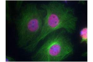 Immunofluorescence staining of methanol-fixed Hela cells using p53 (Phospho-Ser15) Antibody.