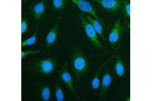 IF analysis of TOMM20 using anti-TOMM20 antibody (ABIN7600883). (TOMM20 anticorps  (AA 25-145))