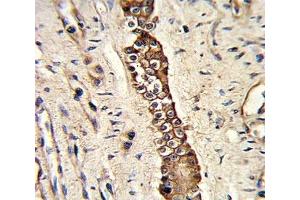 IHC analysis of FFPE human normal lung with DDR2 antibody