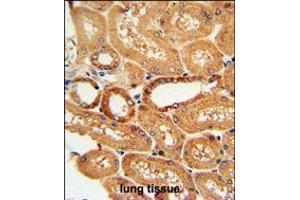 COQ9 Antibody immunohistochemistry analysis in formalin fixed and paraffin embedded human lung tissue followed by peroxidase conjugation of the secondary antibody and DAB staining. (COQ9 anticorps  (AA 156-184))