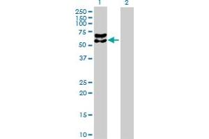 Western Blot analysis of BACE1 expression in transfected 293T cell line by BACE1 MaxPab polyclonal antibody. (BACE1 anticorps  (AA 1-476))