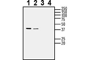 anti-Neuronal Growth Regulator 1 (NEGR1) (Extracellular) antibody