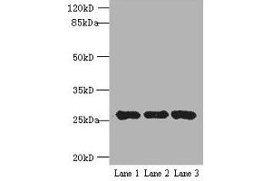 Western blot All lanes: EXOSC5 antibody at 5 μg/mL Lane 1: K562 whole cell lysate Lane 2: 293T whole cell lysate Lane 3: Hela whole cell lysate Secondary Goat polyclonal to rabbit IgG at 1/10000 dilution Predicted band size: 25 kDa Observed band size: 25 kDa (EXOSC5 anticorps  (AA 1-235))