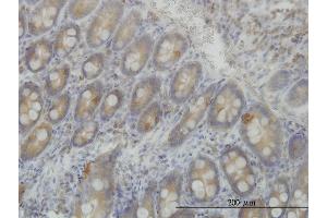 Immunoperoxidase of monoclonal antibody to LRRFIP1 on formalin-fixed paraffin-embedded human small Intestine. (LRRFIP1 anticorps  (AA 675-784))