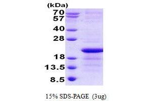 Image no. 1 for Glycoprotein Xg (Xg) protein (His tag) (ABIN6387143) (Glycoprotein Xg Protein (Xg) (His tag))