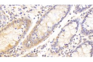 Detection of KNG1 in Human Colon Tissue using Polyclonal Antibody to Kininogen 1 (KNG1)
