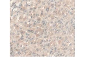 IHC-P analysis of Rat Stomach Tissue, with DAB staining. (Androgen Receptor anticorps  (AA 491-679))