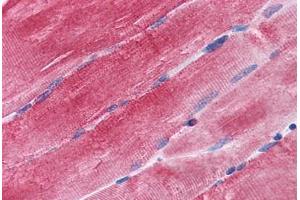 Human Skeletal Muscle: Formalin-Fixed, Paraffin-Embedded (FFPE) (BAG3 anticorps  (AA 563-575))