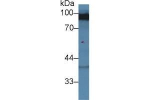Western blot analysis of Rat Cerebrum lysate, using Human DLG3 Antibody (2 µg/ml) and HRP-conjugated Goat Anti-Rabbit antibody ( (MPP3 anticorps  (AA 627-802))