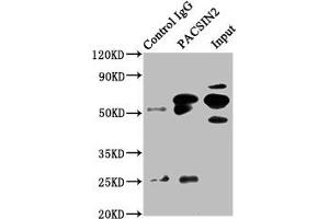 Immunoprecipitating PACSIN2 in HepG2 whole cell lysate Lane 1: Rabbit control IgG instead of ABIN7165686 in HepG2 whole cell lysate. (PACSIN2 anticorps  (AA 240-410))