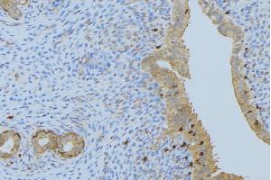ABIN6275893 at 1/100 staining Human uterus tissue by IHC-P. (CPA1 anticorps  (Internal Region))
