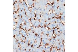Immunohistochemistry of paraffin-embedded human liver using S100 Rabbit mAb (ABIN7270127) at dilution of 1:100 (40x lens). (S100A6 anticorps)