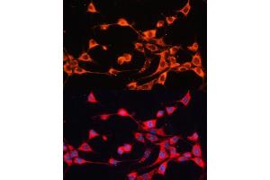Immunofluorescence analysis of NIH/3T3 cells using  antibody (ABIN6129849, ABIN6136345, ABIN6136346 and ABIN6217907) at dilution of 1:100.
