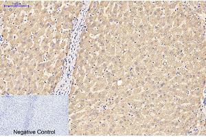 Immunohistochemical analysis of paraffin-embedded human liver tissue. (GFAP anticorps)