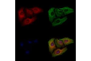 ABIN6255524 and ABIN6267296 staining Hela cells(4h of LPS treatment) by IF/ICC. (HSP27 anticorps  (pSer82))