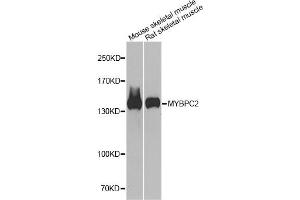 Western blot analysis of extracts of various cell lines, using MYBPC2 antibody. (MYBPC2 anticorps)