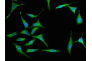 Immunofluorescence staining of Hela cells with ABIN7156645 at 1:100, counter-stained with DAPI.