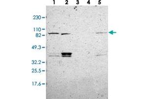 Western blot analysis of Lane 1: RT-4, Lane 2: U-251 MG, Lane 3: Human Plasma, Lane 4: Liver, Lane 5: Tonsil with MAD1L1 polyclonal antibody  at 1:250-1:500 dilution.