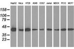 Western blot analysis of extracts (35 µg) from 9 different cell lines by using anti-IVD monoclonal antibody. (IVD anticorps)