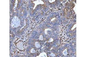 IHC analysis of Hsp47/SERPINH1 using anti-Hsp47/SERPINH1 antibody (ABIN3043331). (SERPINH1 anticorps  (AA 247-418))