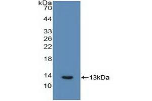 Detection of Recombinant IL6R, Human using Polyclonal Antibody to Interleukin 6 Receptor (IL6R) (IL-6 Receptor anticorps  (AA 216-356))