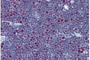 Human Thymus: Formalin-Fixed, Paraffin-Embedded (FFPE)