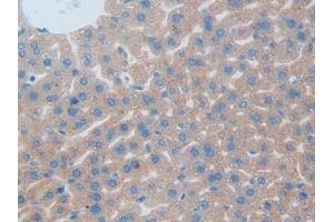 Detection of CD301 in Mouse Liver Tissue using Polyclonal Antibody to Cluster Of differentiation 301 (CD301)