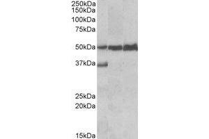 Western Blotting (WB) image for anti-Lymphocyte-Specific Protein 1 (LSP1) (C-Term) antibody (ABIN2464618) (LSP1 anticorps  (C-Term))