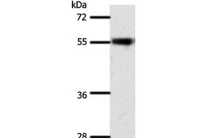 Western Blot analysis of Mouse eye tissue using SLC32A1 Polyclonal Antibody at dilution of 1:500 (SLC32A1 anticorps)
