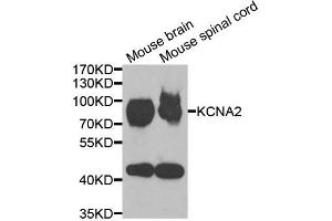 Western blot analysis of extracts of various cell lines, using KCNA2 antibody (ABIN5973718) at 1/1000 dilution.