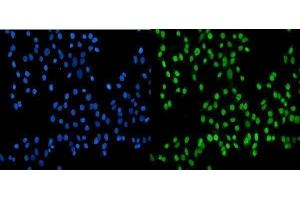 anti-Sjogren Syndrome Antigen B (SSB) (AA 6-283) antibody