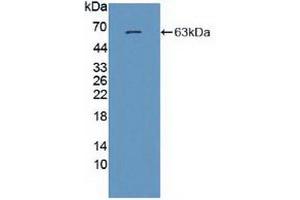 Western blot analysis of recombinant Human GRIN2A. (NMDAR2A anticorps  (AA 31-555))