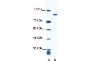 Western Blotting (WB) image for anti-Kinesin Family Member 23 (KIF23) antibody (ABIN2460845) (KIF23 anticorps)