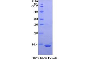 SDS-PAGE analysis of Mouse S100 Protein.