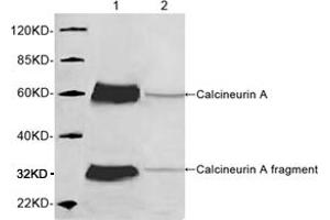 Western blot analysis of mouse brain tissue lysate using 1 µg/mL Rabbit Anti-Calcineurin A Polyclonal Antibody (ABIN398733) Lane 1: Rabbit Anti-Calcineurin A Polyclonal AntibodyLane 2: Rabbit Anti-Calcineurin A Polyclonal Antibody pre-incubated with immunizing peptideThe signal was developed with IRDyeTM 800 Conjugated Goat Anti-Rabbit IgG. (Calcineurin A anticorps  (AA 450-500))
