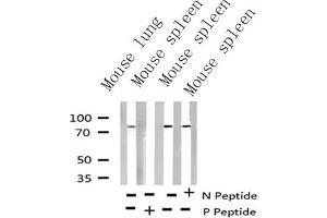 Western blot analysis of Phospho-Myb (Ser532) Antibody expression in mouse lung and mouse spleen tissues lysates. (MYB anticorps  (pSer532))