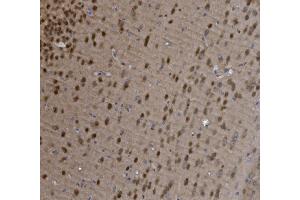 IHC analysis of MEF2C using anti-MEF2C antibody (ABIN6719606). (MEF2C anticorps)